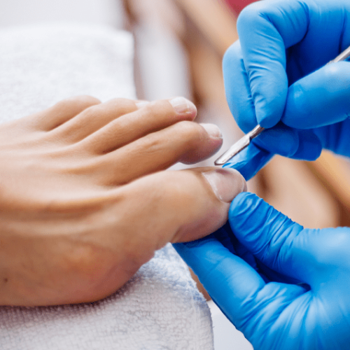 pedicure-process-home-salon-pedicure-foot-care-treatment-nail-process-professional-pedicures-master-blue-gloves-make-pedicure 3-min